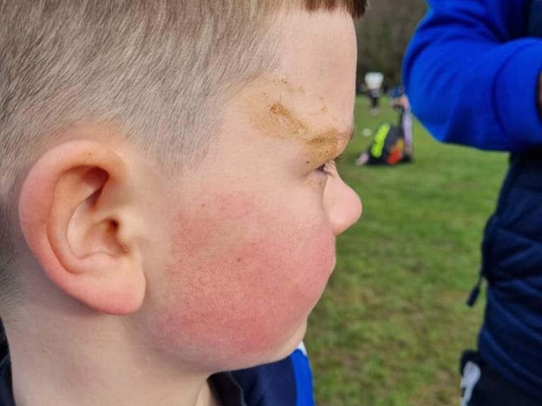 An eight-year-old boy fell face first in dog mess while playing rugby on a pitch where the animals are banned_ (002)
